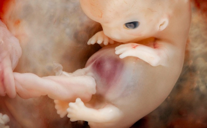7-8-week-embryo.jpg