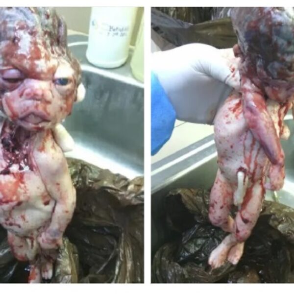 Aborted baby images given to Operation Rescue by former staff at Houston abortion facility