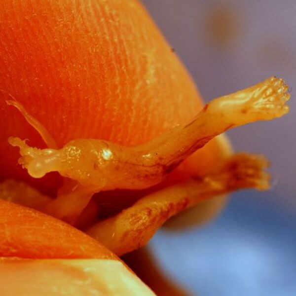 An aborted fetus’s leg with thigh bone protruding. 8 weeks gestation. 