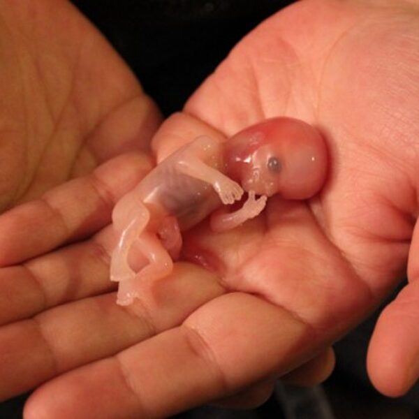 A 12 week old baby aborted