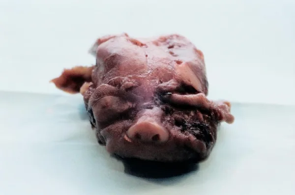 A precious baby aborted at 21 weeks.