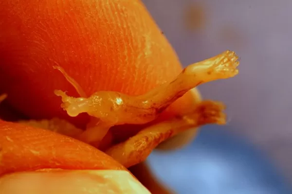 An aborted fetus’s leg with thigh bone protruding. 8 weeks gestation. 