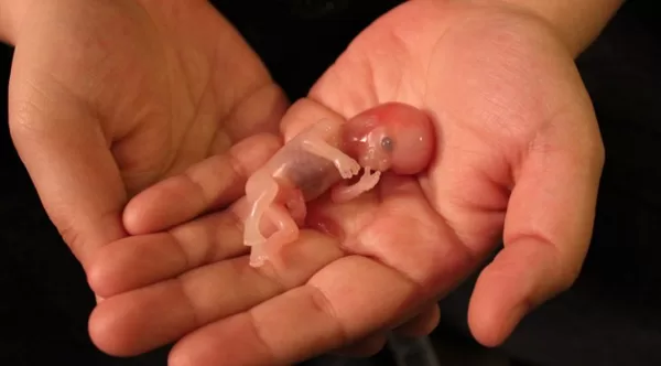 A 12 week old baby aborted
