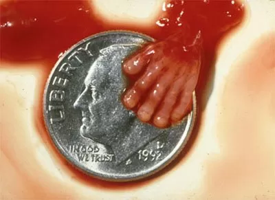 Aborted at first trimester 